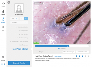 MEDELINK | API-202 Portable skin and scalp analyzer